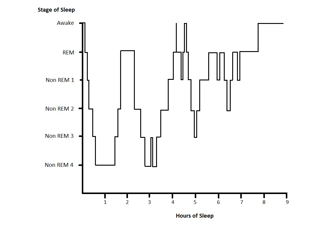 The Role of REM Sleep: Unraveling Its Importance in Restorative Sleep